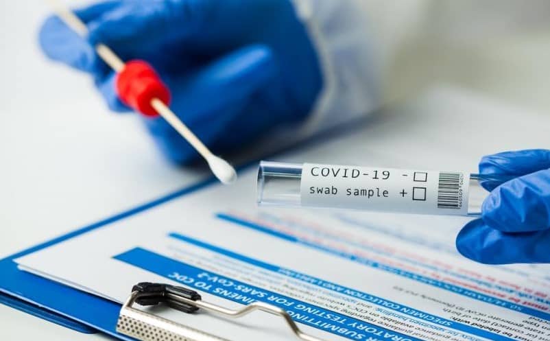 Covid-PCR-Test